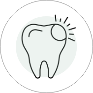 illustration of cosmetic bonding